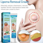 South Moon Lipoma Removal Cream Lipolysis Fat Lump Relieve Plaster Skin Swelling Ointment Subcutaneous Lumps Dredge Dissipate Body Care（20g）