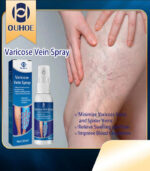 Varicose Vein Spray Relief Veins Minimize Varicose Veins and Spider Veins
